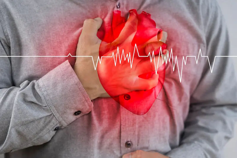 Irregular Heartbeat After Angioplasty